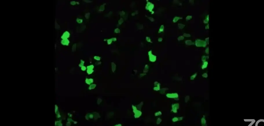 cytoskeletons of human cells